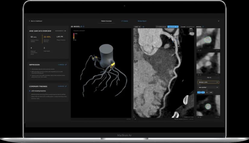 Artrya Adds Cone Health to U.S. Roster, Notching Third Major Win for Salix® Platform