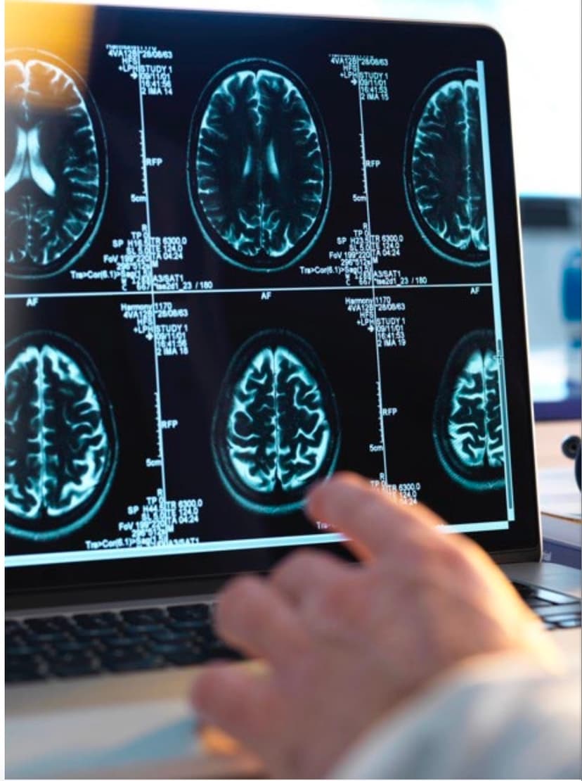 Neurizon’s Fresh Capital Injection Paves the Way for Phase 3 ALS Trial